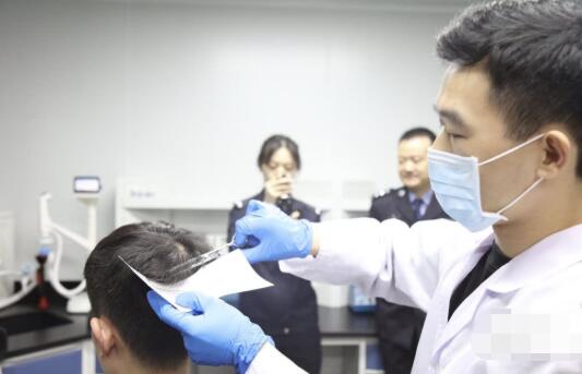 毛发毒品检测